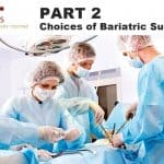 types of bariatric surgery