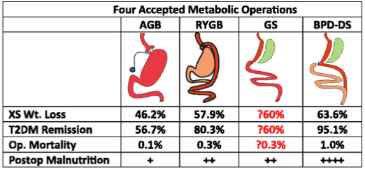 four accepted metabolic operations for treating diabetes
